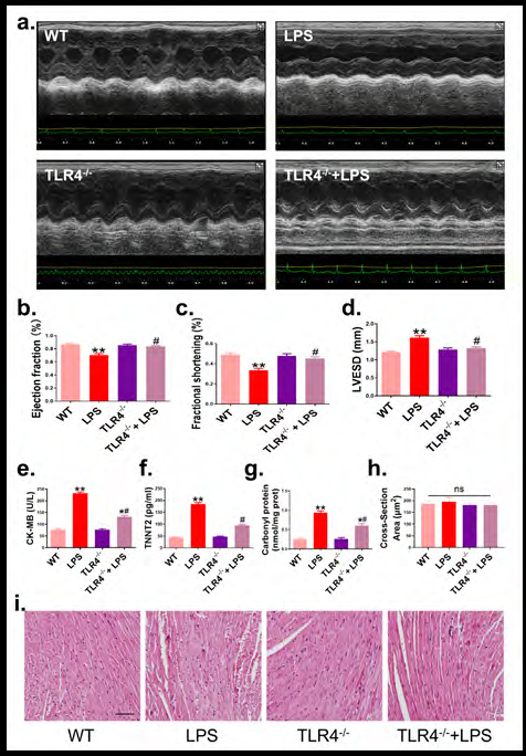 Deletion of TLR4 Ameliorates Inflammation Response and Apoptosis in Septic Cardiomyopathy (SCM)