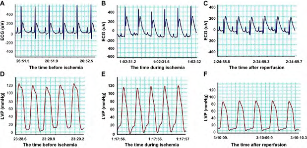 Vitamin C Post Conditioning Alleviates Myocardial is-Chemia-Reperfusion Injury by Inhibiting Oxidative Stress in A Rat Model