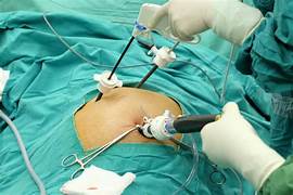 Role of Intraoperative Cholangiography in Selective Laparoscopic Cholecystectomy