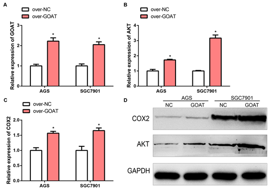 Ghrelin-O-Acetyltransferase Could Affect the Cell Proliferation, Apoptosis and Autophagy of Gastric Cancer by Regulating AKT